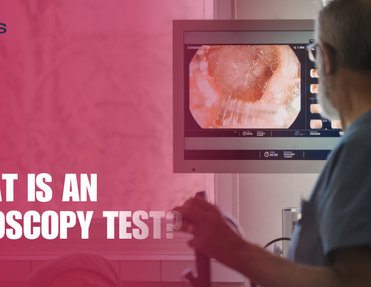 What Is an Endoscopy Test
