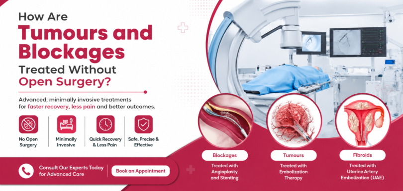 Interventional Radiology Services